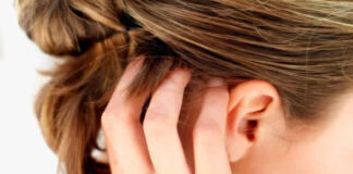 Como acabar com a caspa