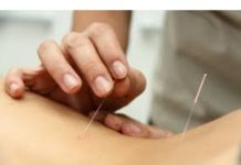 O método da acupuntura