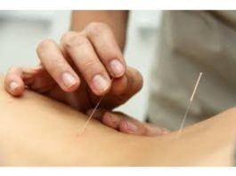 O método da acupuntura