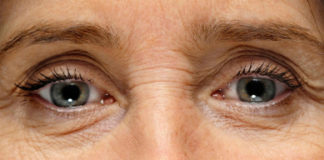 Evitar rugas nos olhos