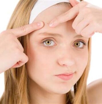 Peles com problemas de acne Problemas de acne