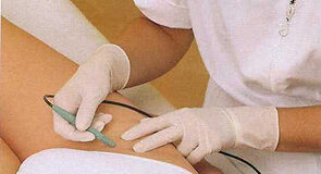 Electrólise - depilação eléctrica