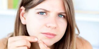 Acne na adolescência