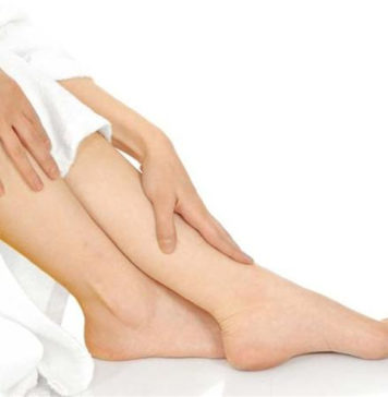 Previna-se das varizes