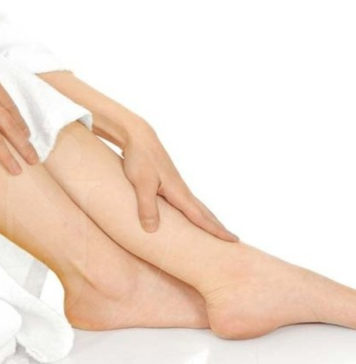 Varizes, saiba com tratá-las