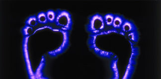 Saiba o que é a Kirliangrafia