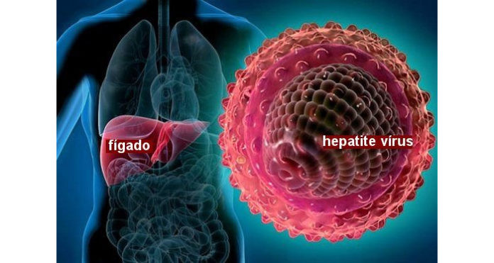 Hepatites