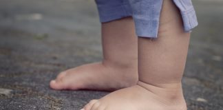 O meu filho sofre de obesidade, e agora?